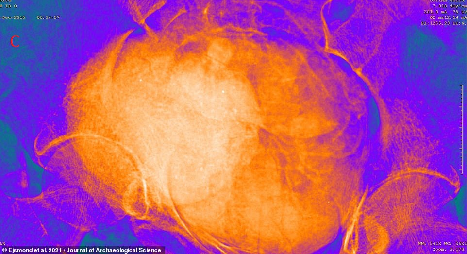 'Blood pH in corpses, including content of the uterus, falls significantly, becoming more acidic, and the concentrations of ammonia and formic acid increase with time,' the team said. 'The placement and filling of the body with natron significantly limited the access of air and oxygen. The end result is an almost hermetically sealed uterus containing the foetus. The foetus was in an environment comparable to the one which preserves ancient bodies to our time in swamps'