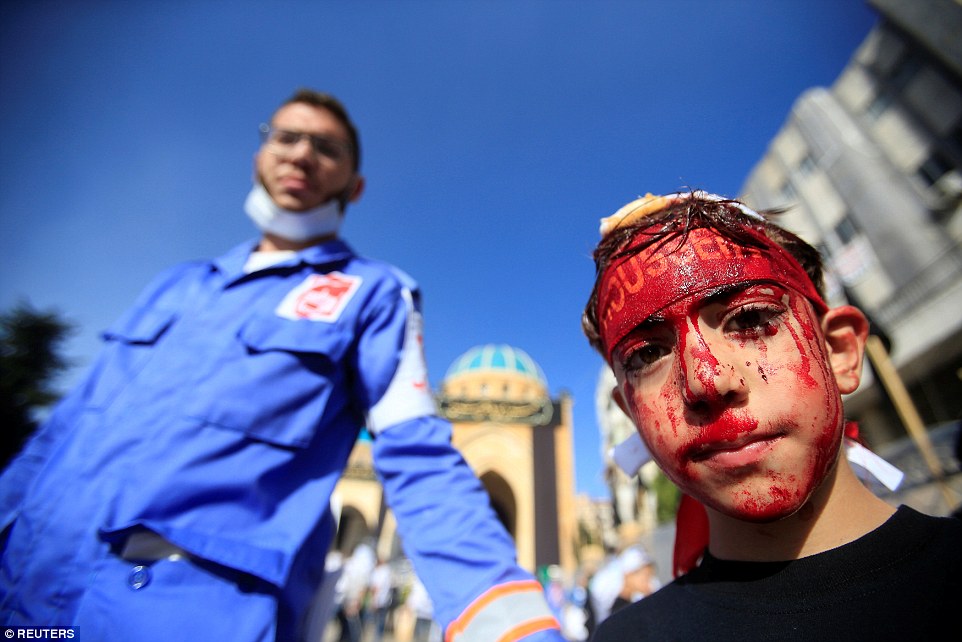 A boy looks down into the camera as blood drips from his head during processions in Nabatiyeh town, Lebanon on October 12 